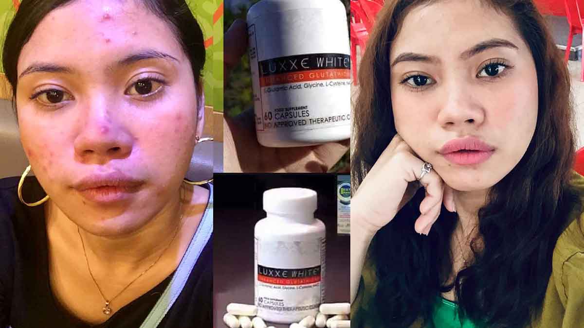 Luxxe White and Luxxe Protect Testimony by Marie Nila Englis Serada