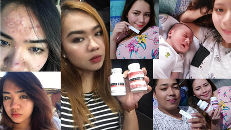 how does glutathione pills work Glutathione Tablets For Skin Whitening: How To Use, Benefits & Side Effects how does glutathione pills work Glutathione Tablets For Skin Whitening: How To Use, Benefits & Side Effects