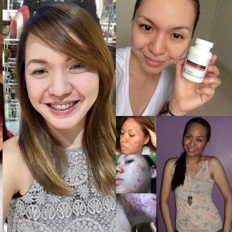 Luxxe White Enhanced Glutathione #1 Most Effective Skin Whitening